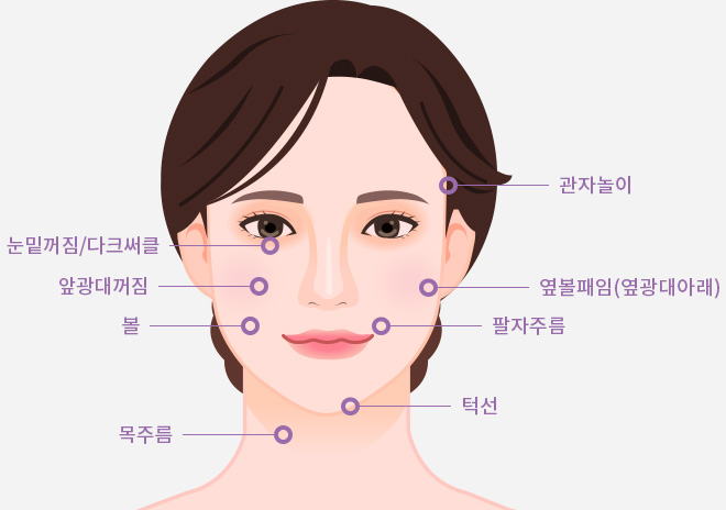 필러 시술부위 (정면)