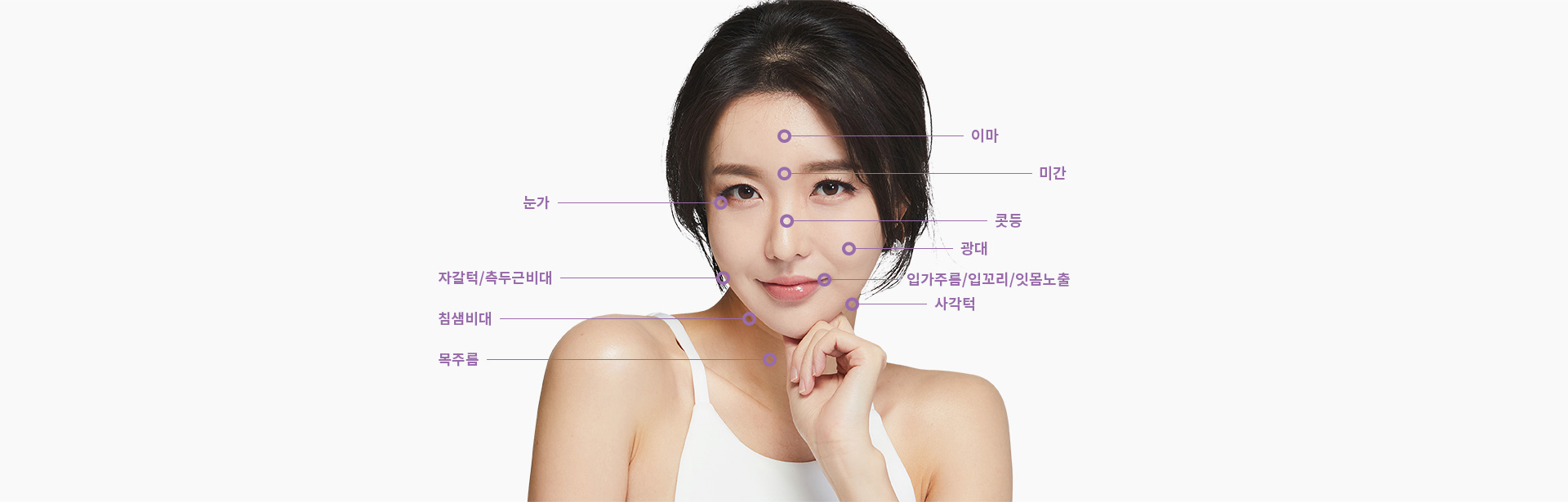 얼굴 보톡스 시술부위