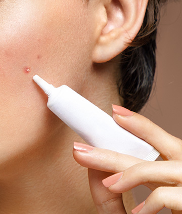 경구약/국소도포제